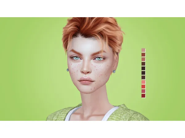 Pimples 03 BY Soloriya