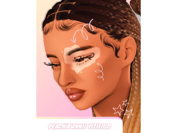 Maxis Match Peachi Vitiligo V1 by Peachibunnii - The Sims 4 Custom Content