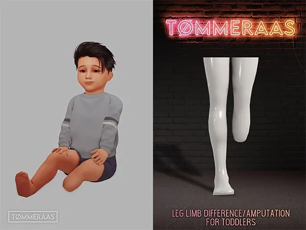Mix Tu00d8MMERAAS Leg Limb DifferenceAmputation for Toddlers - The Sims 4 Custom Content